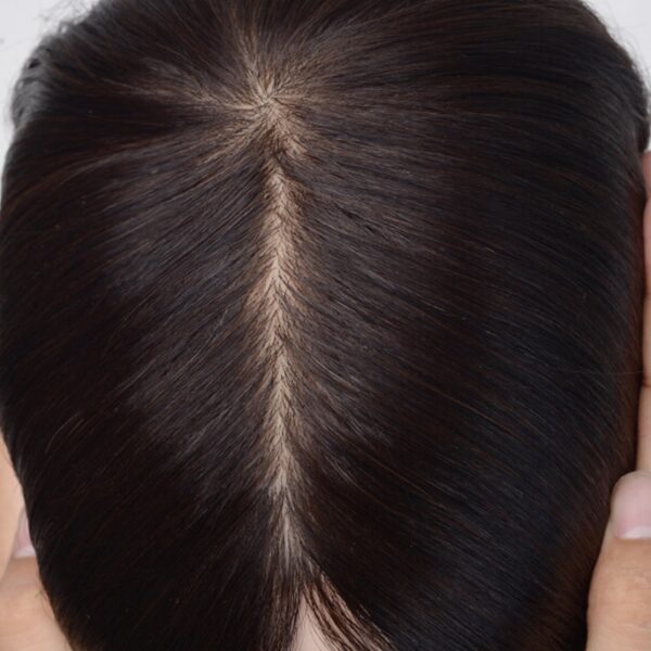 Silk-Top-Hair-System-with-Injected-Skin-Perimeter-2