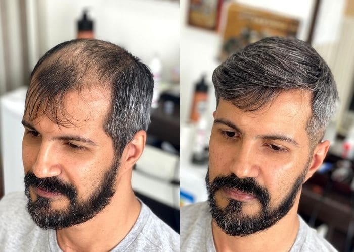 haircuts-for-thinning-hair-men-and-balding-men-3