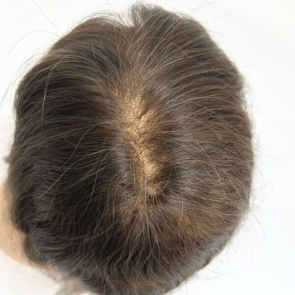 LL026078-Fine-Mono-Hair-System-with-Poly-around-4