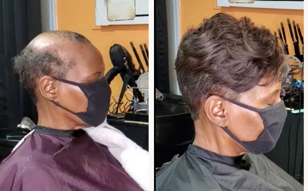 Before and after one of our Afro clients had one of our women‘s hair systems installed in a salon
