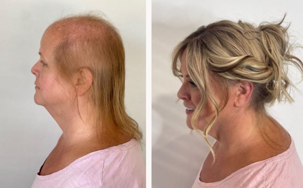 women's toupee before&after (1)